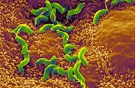 Nhiễm trùng Helicobacter Pylori ở dạ dày