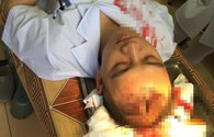 Sở Y tế Hà Nội vào cuộc vụ bác sĩ bị người nhà bệnh nhân đánh bất tỉnh