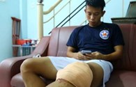 Anh Khoa sang Singapore chữa trị chấn thương dự kiến khoảng 600 triệu đồng