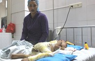 LD1827: Bé trai 4 tuổi bị bỏng nặng đang rất cần sự trợ giúp
