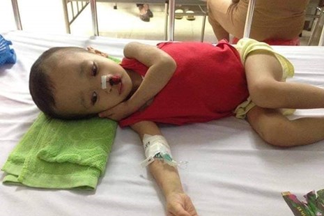 Con trai 4 tuổi mắc bệnh "lạ", gia đình lực bất tòng tâm kêu cứu