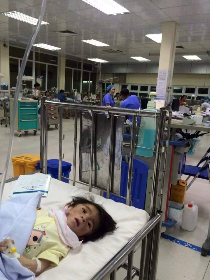 Hình ảnh bé gái suy dinh dưỡng nặng tại bệnh viện