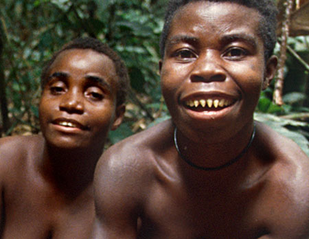 Thức ăn thiếu iốt là một trong những nguyên nhân khiến căn bệnh bướu cổ rất phổ biến với người Pygmy.